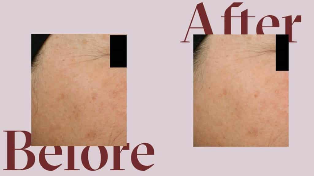 Proven Skincare Review - Must Read This Before Buying